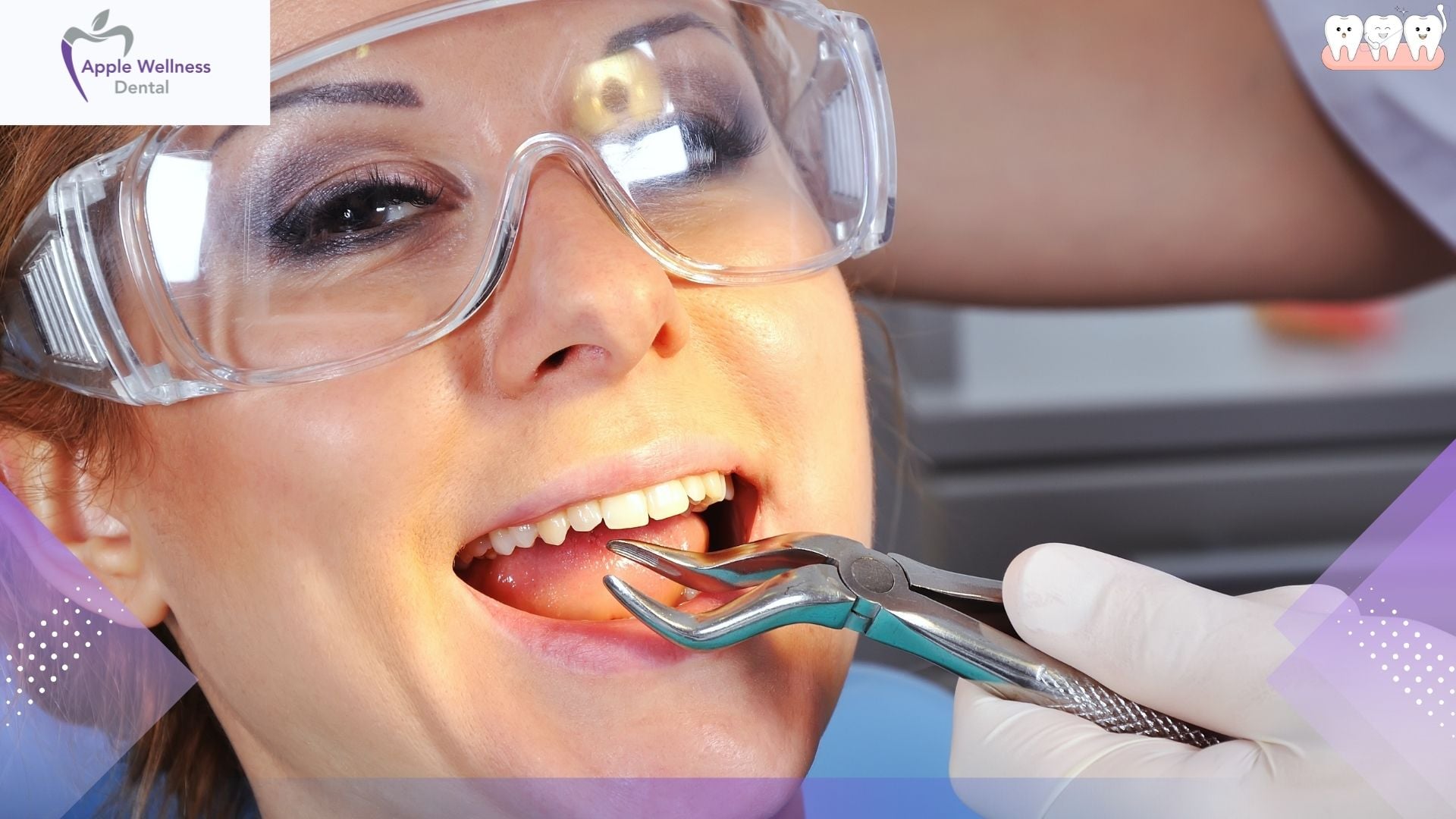 The Complete 2026 Guide to Dental Recovery: What and When to Eat Post-Extraction - Apple Wellness Dental The Complete 2026 Guide to Dental Recovery: What and When to Eat Post-Extraction - Apple Wellness Dental
