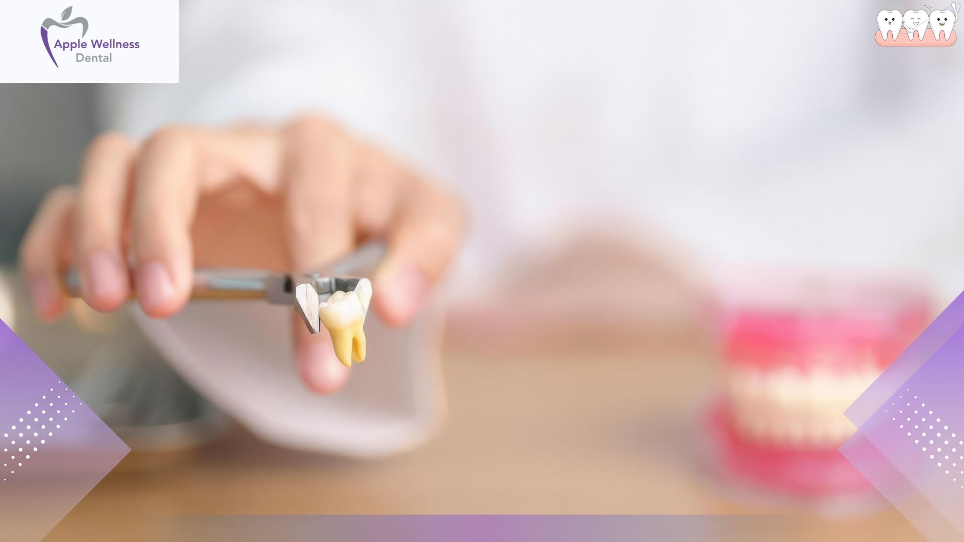 The Complete Guide to Bone Graft Timelines After Tooth Extraction - Apple Wellness Dental The Complete Guide to Bone Graft Timelines After Tooth Extraction - Apple Wellness Dental